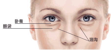 卧蚕和眼袋究竟有啥区别？看完你就会明白